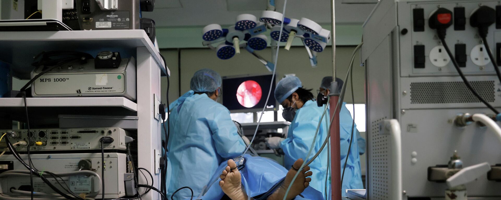 Médicos realizan una endoscopia a un paciente con hongo negro o mucormicosis en Nueva Deli, India - Sputnik Mundo, 1920, 02.06.2021
