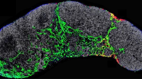 Ganglio linfático de un ratón en el que se visualizan los vasos linfáticos (verde) y los exosomas tumorales (rojo) que dirigirán las primeras etapas de la metástasis del melanoma - Sputnik Mundo