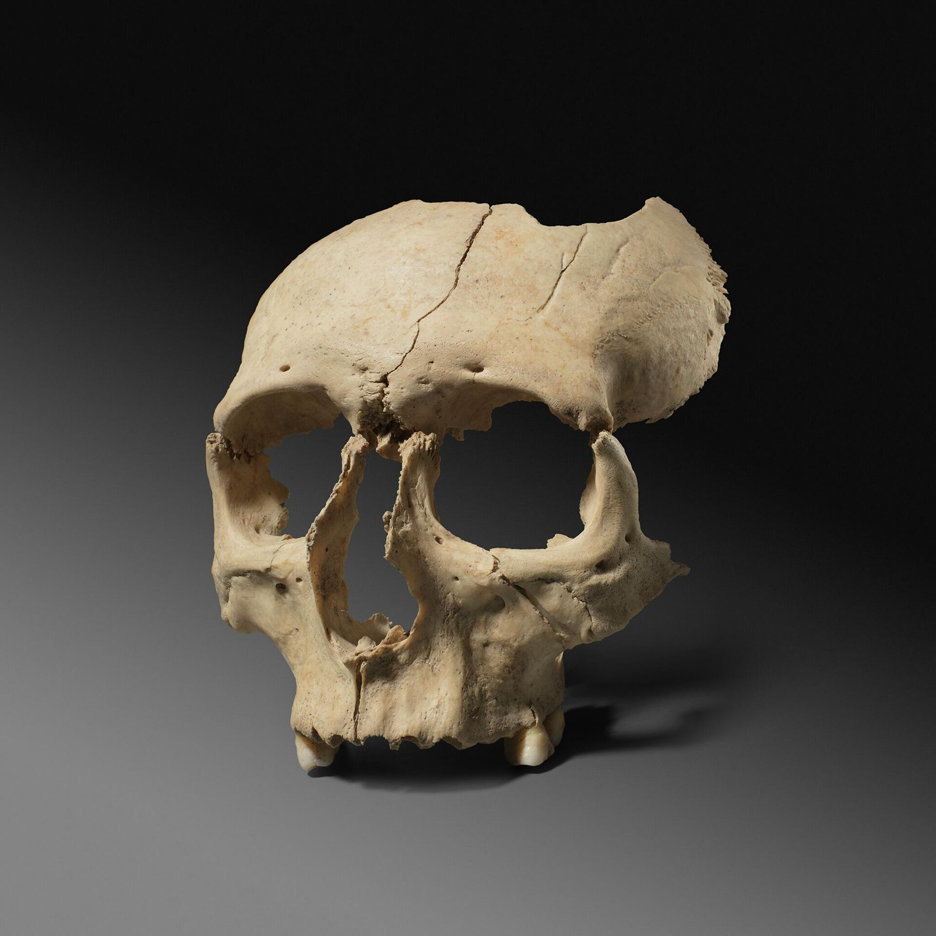 Cráneo de Olèrdola - Sputnik Mundo, 1920, 14.01.2022