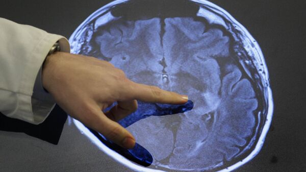 tomografía cerebro - Sputnik Mundo