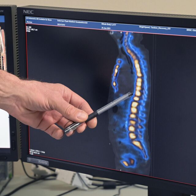 Síntomas de la escoliosis: cómo prevenir esa enfermedad y curarla