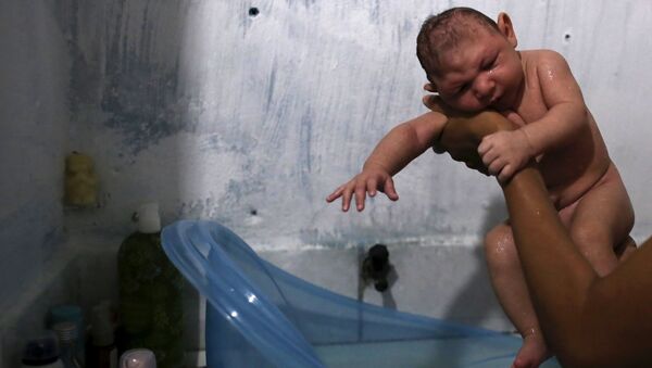 Niño brasileño con microcefalia - Sputnik Mundo