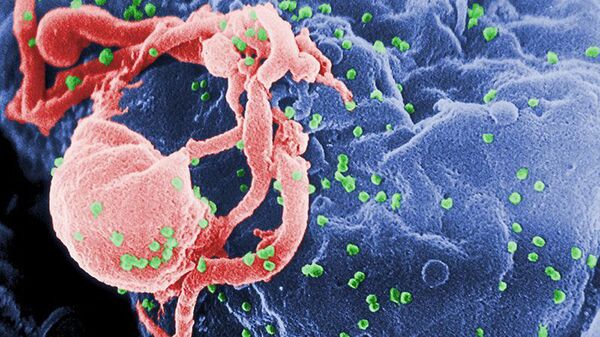 VIH-1 en liberación (en verde) en un cultivo de linfocitos - Sputnik Mundo