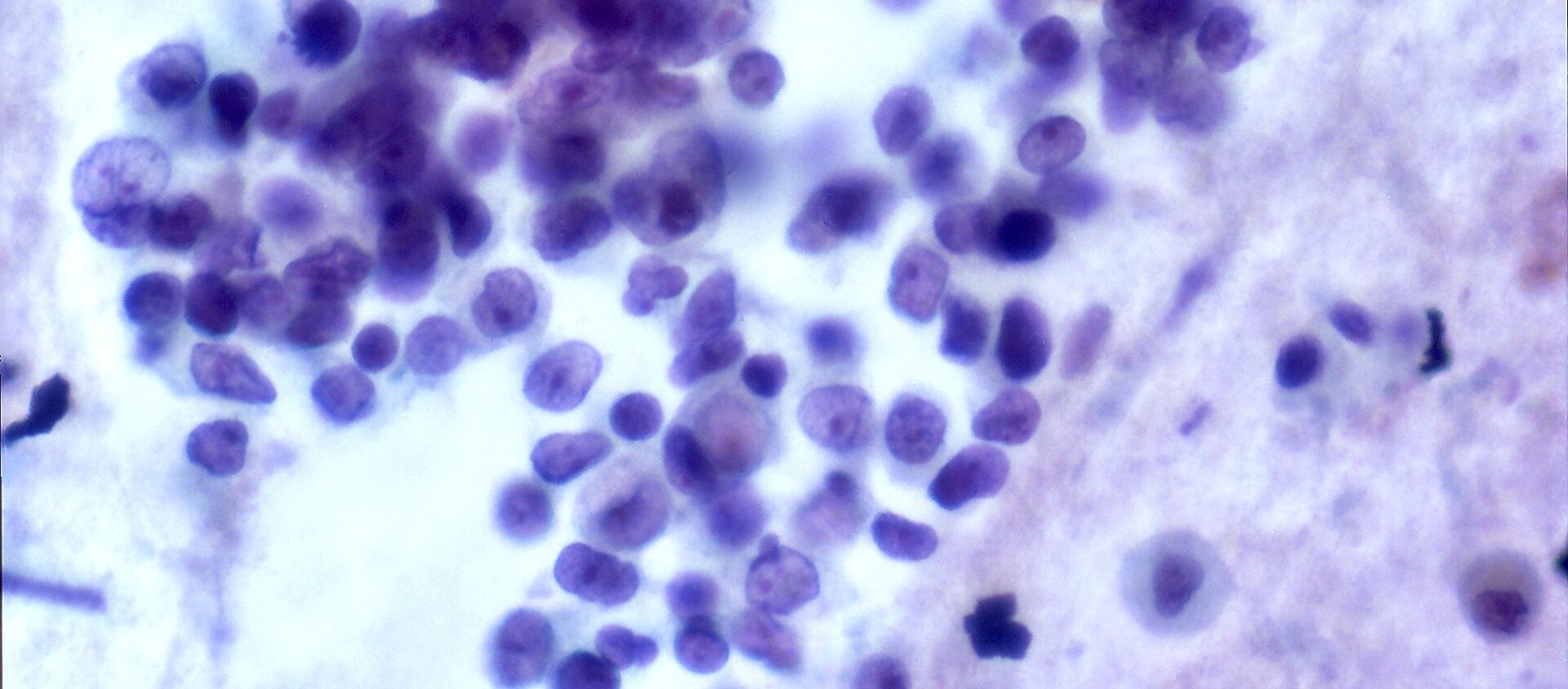 Células de cáncer Células de cáncer - Sputnik Mundo, 1920, 09.10.2020