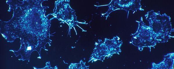 Células de cáncer Células de cáncer - Sputnik Mundo