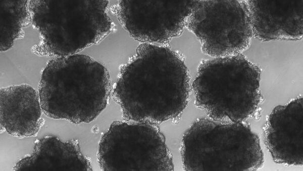 Microcerebro creado por Muotri bajo el microscopio - Sputnik Mundo