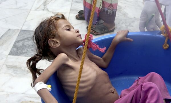 Niña yemení sufre de malnutrición, consecuencia de la guerra y el bloqueo de Arabia Saudí, 25 de agosto de 2018, Hajjah (Yemen) Niña yemení sufre de malnutrición, consecuencia de la guerra y el bloqueo de Arabia Saudí, 25 de agosto de 2018, Hajjah (Yemen) - Sputnik Mundo