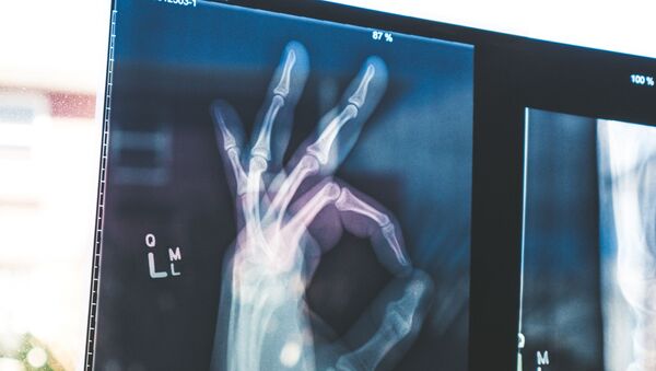 Radiografia de la mano (imagen referencial) - Sputnik Mundo
