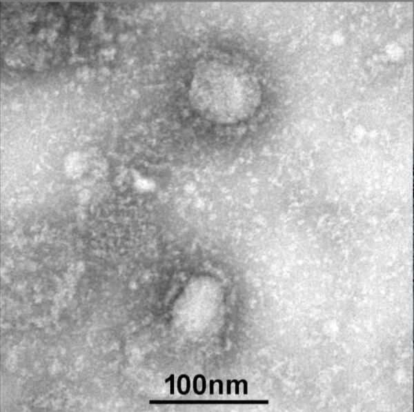 China publica la primera imagen del coronavirus China publica la primera imagen del coronavirus - Sputnik Mundo