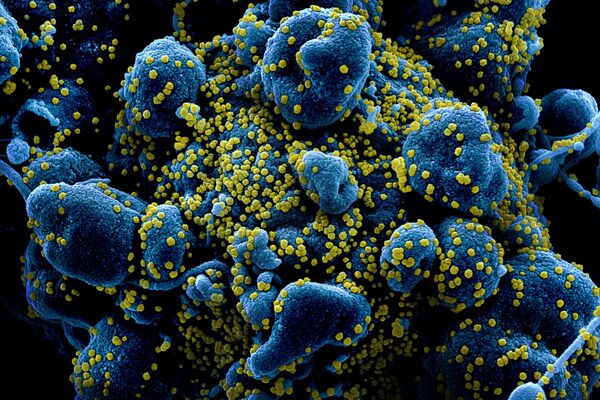 Una célula rodeada por el coronavirus SARS-CoV-2 Una célula rodeada por el coronavirus SARS-CoV-2 - Sputnik Mundo