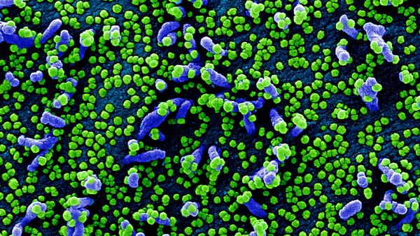 Micrografía electrónica coloreada de una célula humana (azul) infectada por el virus SARS-COV-2 (verde) - Sputnik Mundo