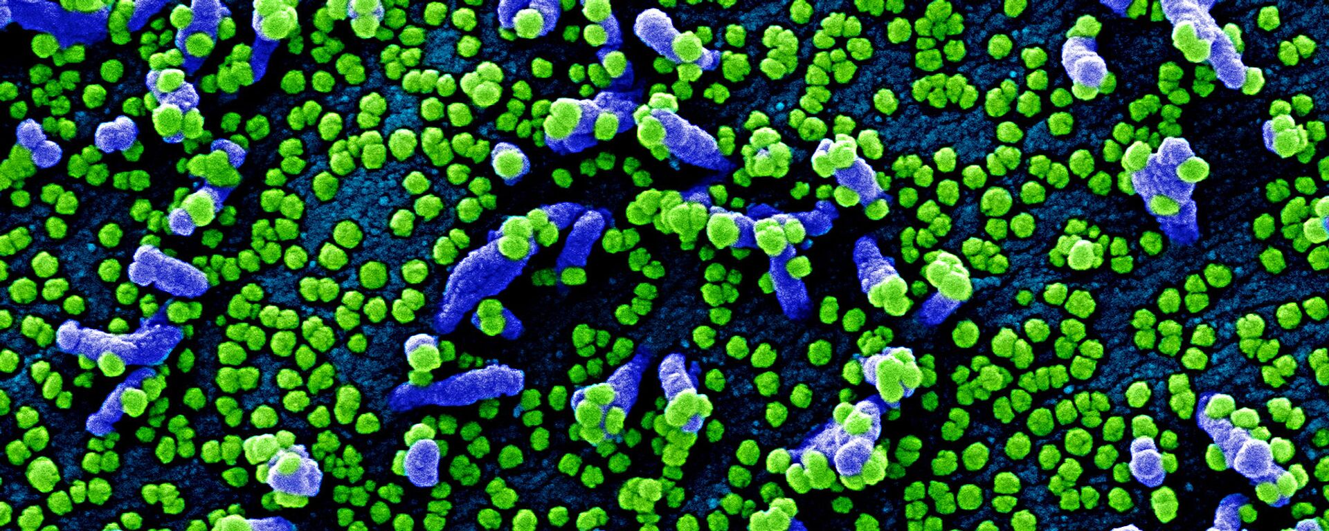 Micrografía electrónica coloreada de una célula humana (azul) infectada por el virus SARS-COV-2 (verde) - Sputnik Mundo, 1920, 30.08.2021