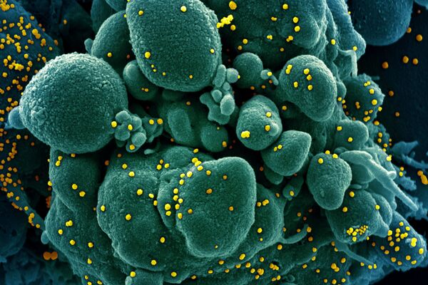 Micrografía electrónica coloreada de una célula humana (azul-verde) infectada por el virus SARS-COV-2 (amarillo) - Sputnik Mundo