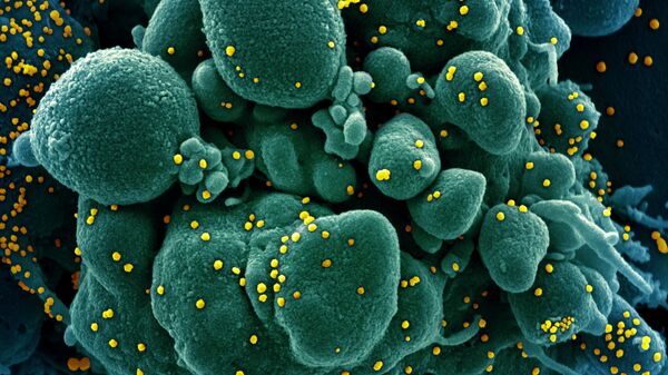Micrografía electrónica coloreada de una célula humana (azul-verde) infectada por el virus SARS-COV-2 (amarillo) - Sputnik Mundo