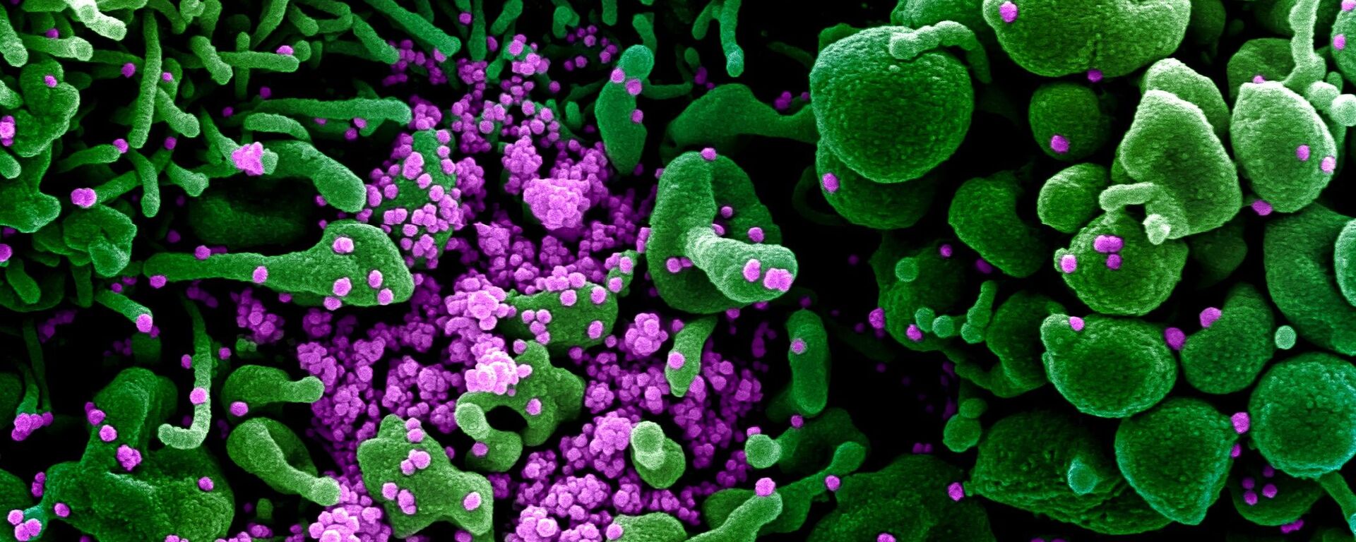 Micrografía electrónica coloreada de una célula humana (verde) infectada por el virus SARS-COV-2 (violeta) - Sputnik Mundo, 1920, 30.03.2021