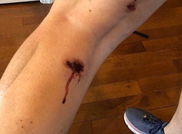 Nicole Roussell, periodista del Sputnik, herida por la policía mientras cubría una manifestación en Washington - Sputnik Mundo