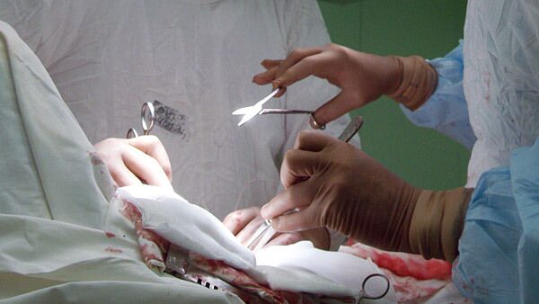 Cirujanos rusos realizaron más de 1.300 transplantes de órganos en 2010 - Sputnik Mundo