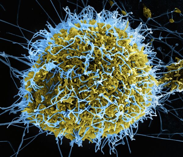 El vírus del Ébola - Sputnik Mundo