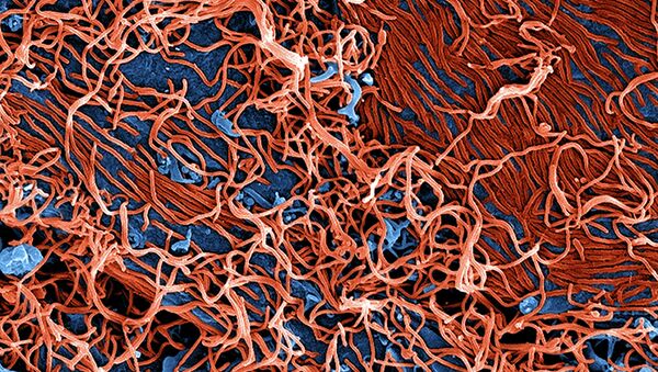 El virus de ebola bajo el microscopio - Sputnik Mundo