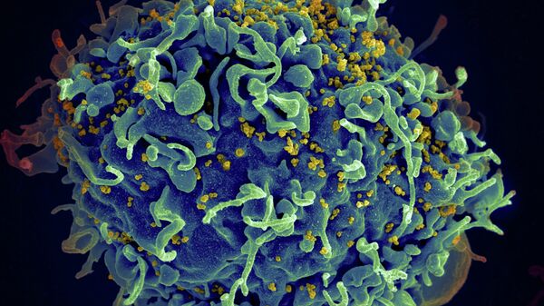 VIH, el virus del SIDA (amarillo), que está infectando una célula humana - Sputnik Mundo